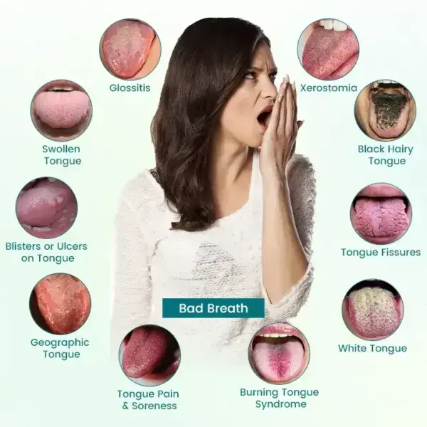 LOVILDS® GlosShield Tongue Repair Spray